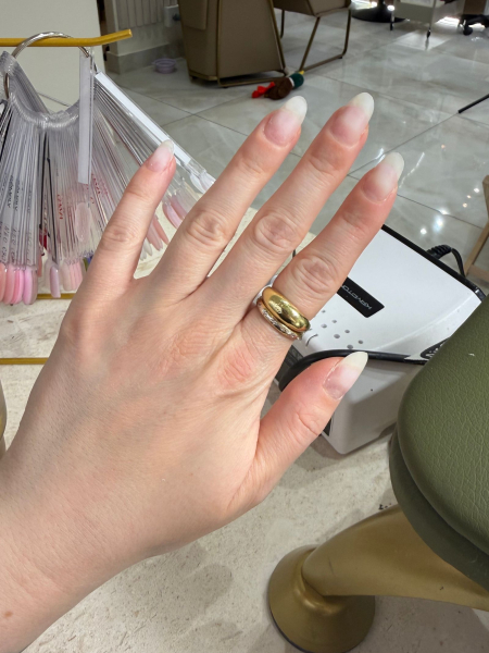 Writer Lucy Abberstseen's hand and nails after her gel polish has been removed at a Ukrainian manicure appointment.